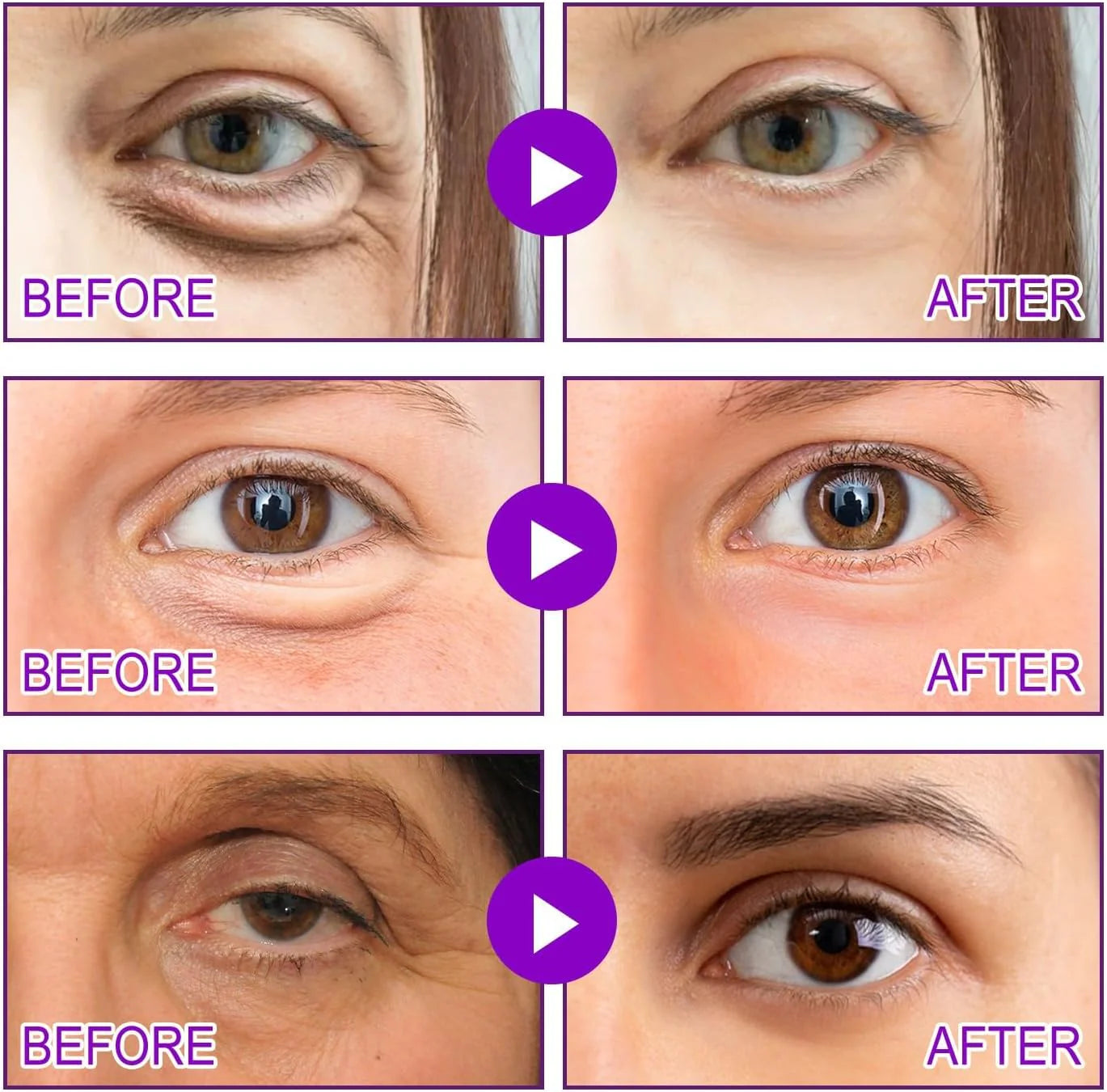 NovaLift MicroGlow-System